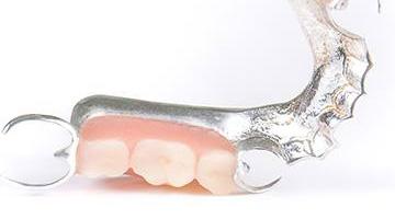 Partial metal dentures in Colleyville   