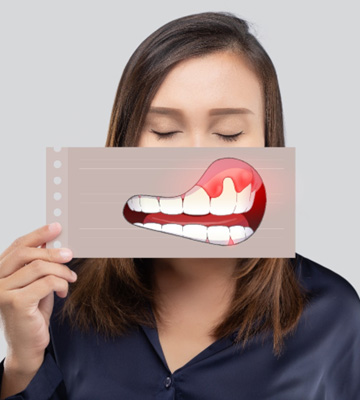 Woman holding picture of gum disease in front of her face