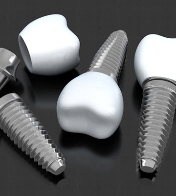 Diagram showing components of dental implants in Colleyville