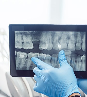 Digital x-rays on tablet computer