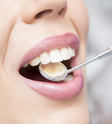 Closeup of smile during dental exam