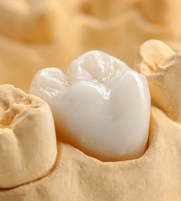 Model smile with zirconia dental crown