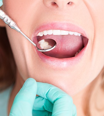 Closeup of smile during dental exam