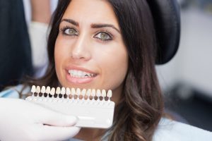 woman with porcelain veneers