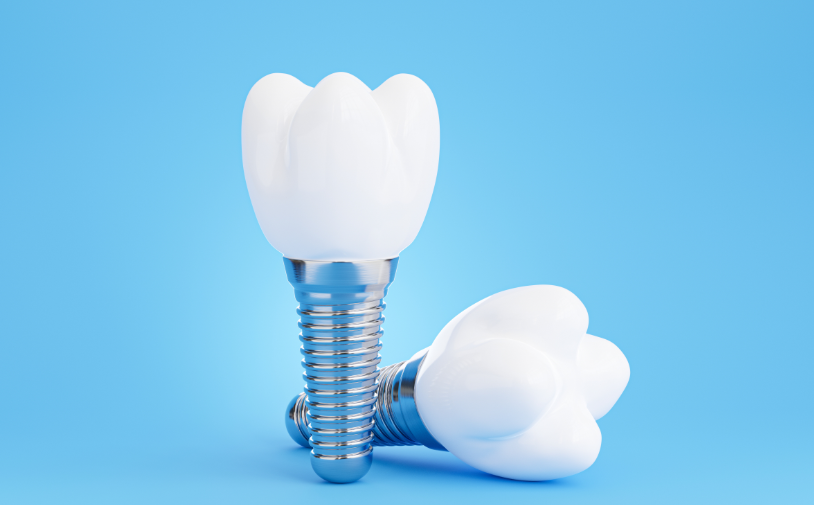 Dental implants